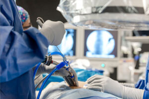 foto endoscopia da coluna