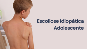 A imagem possui uma criança com escoliose idiopática.